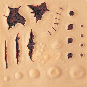 Assorted Scars and Wound