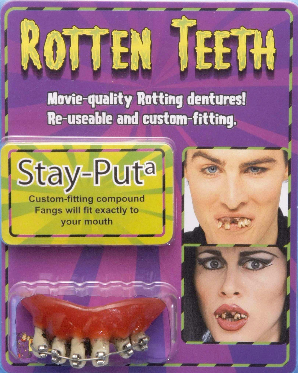 Hillbilly Teeth with Braces