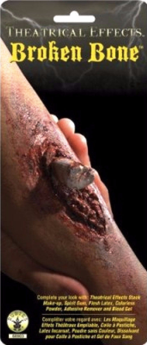 FX Broken Bone